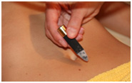 Moxibustion